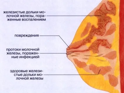 Містить після пологів чому з'являється, як лікувати самостійно і уникнути його (лікувати) Містить після пологів чому з'являється, як лікувати самостійно і уникнути його