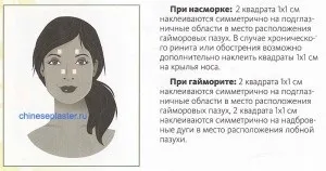 Куди клеїти китайські пластирі - фото-інструкція (пластирі) Куди клеїти китайські пластирі - фото-інструкція
