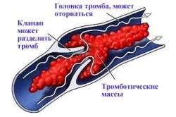 Чи можна болгарський перець мамі, що годує як краще вживати болгарський перець в період лактації (годує) Чи можна болгарський перець мамі, що годує як краще вживати болгарський перець в період лактації