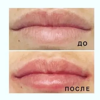 My clinic (@my_clinic_yalta) - instaliga is the best instagram web-viewer (_______________________________________________________ yalta ялта yaltagram) My clinic (@my_clinic_yalta) - instaliga is the best instagram web-viewer