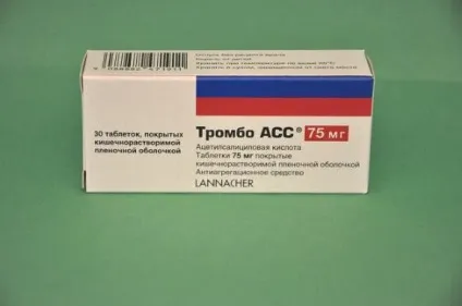 Чи можна літати після інсульту