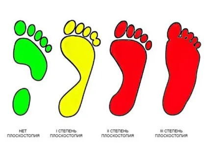 Мрт стопи - що показує