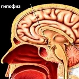 Недостатність функції гіпофіза і гіпоталамуса симптоми нестачі гормону (гіпоталамуса) Недостатність функції гіпофіза і гіпоталамуса симптоми нестачі гормону