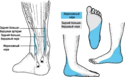 Оніміння ноги від коліна до стопи - причини і лікування (причини) Оніміння ноги від коліна до стопи - причини і лікування