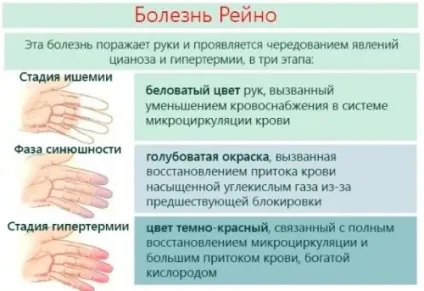 Оніміння ноги від коліна до стопи - причини і лікування (правої) Оніміння ноги від коліна до стопи - причини і лікування