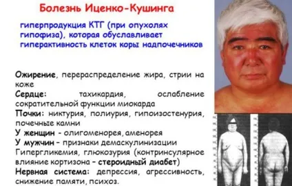 Відхилення гіпофіза головного мозку симптоми порушення функцій (порушення) Відхилення гіпофіза головного мозку симптоми порушення функцій