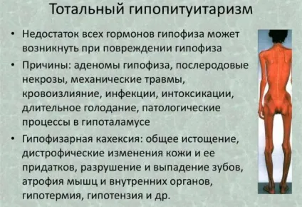 Відхилення гіпофіза головного мозку симптоми порушення функцій (головного) Відхилення гіпофіза головного мозку симптоми порушення функцій