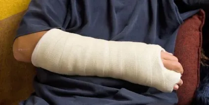 Перелом головки променевої кістки ліктьового суглоба симптоми, лікування і відновлення ліктя з (головки) Перелом головки променевої кістки ліктьового суглоба симптоми, лікування і відновлення ліктя зі