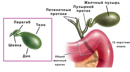 Перегин шийки жовчного міхура симптоми і лікування 1 (міхура) Перегин шийки жовчного міхура симптоми і лікування 1
