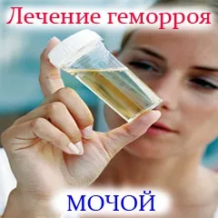 Лікування геморою сечею (лікування) Лікування геморою сечею
