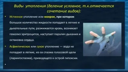 Перша допомога при утопленні коротко по пунктах (утопленні) Перша допомога при утопленні коротко по пунктах
