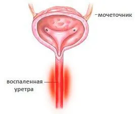 Чому болить правий бік захворювання, діагностика, методи лікування (правий бік) Чому болить правий бік захворювання, діагностика, методи лікування