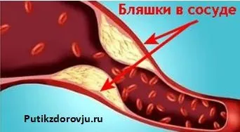 Корисні властивості квашеної капусти (квашеної) Корисні властивості квашеної капусти