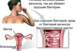Причини появи виділень зеленуватого кольору без запаху (виділень) Причини появи виділень зеленуватого кольору без запаху