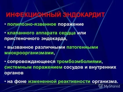 Презентація на тему інфекційний ендокардит ( «барабанні пальці» «вартові) Презентація на тему інфекційний ендокардит
