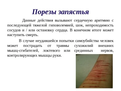 Презентація основні способи відходу з життя