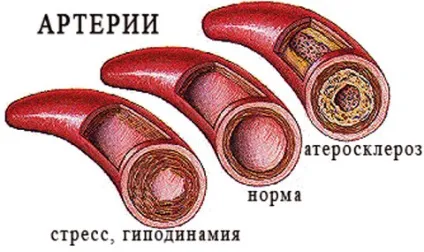Продукти для розрідження крові список, при вагітності, варикозі, тромбозі, без аспірину, після 50 (список) Продукти для розрідження крові список, при вагітності, варикозі, тромбозі, без аспірину, після 50