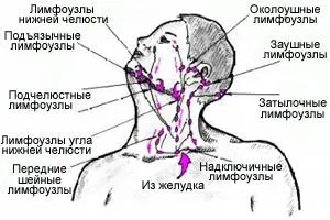 Розташування лімфовузлів на тілі людини (фото) (людини) Розташування лімфовузлів на тілі людини (фото)
