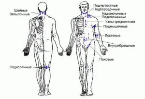 Розташування лімфовузлів на тілі людини (фото) (дуже цікаво) Розташування лімфовузлів на тілі людини (фото)