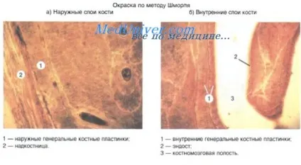 Регенерація кістки після перелому (кістки) Регенерація кістки після перелому