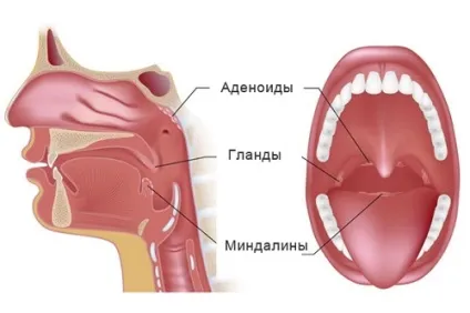 Дитина хропе уві сні що може викликати подібне явище (дитина) Дитина хропе уві сні що може викликати подібне явище