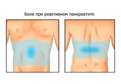 Реактивний панкреатит ознаки, симптоми і лікування патології (реактивний) Реактивний панкреатит ознаки, симптоми і лікування патології