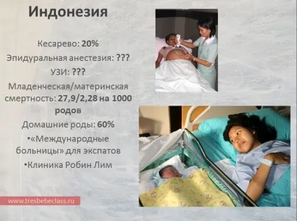 Пологи в різних країнах світу - - class - Новомосковскйте також - статті - пологи (пологи) Пологи в різних країнах світу - - class - Новомосковскйте також - статті - пологи