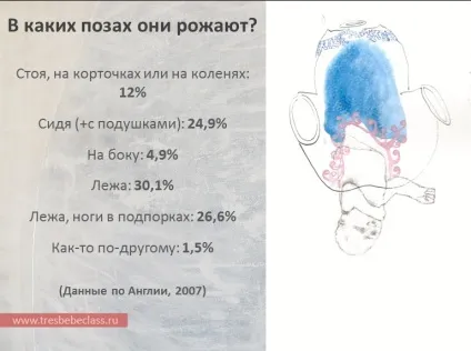 Пологи в різних країнах світу - - class - Новомосковскйте також - статті - пологи (світу) Пологи в різних країнах світу - - class - Новомосковскйте також - статті - пологи
