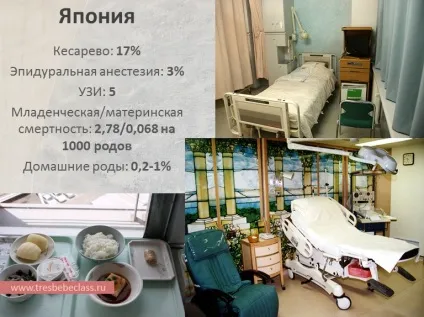 Пологи в різних країнах світу - - class - Новомосковскйте також - статті - пологи (різних) Пологи в різних країнах світу - - class - Новомосковскйте також - статті - пологи