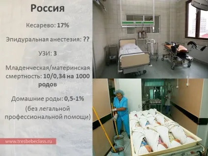 Пологи в різних країнах світу - - class - Новомосковскйте також - статті - пологи (пологи) Пологи в різних країнах світу - - class - Новомосковскйте також - статті - пологи
