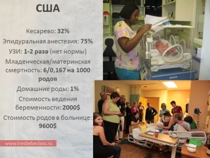 Пологи в різних країнах світу - - class - Новомосковскйте також - статті - пологи (class) Пологи в різних країнах світу - - class - Новомосковскйте також - статті - пологи