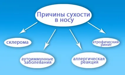 Лікування сухості в носі в домашніх умовах - як зволожити слизову народними засобами (сухості) Лікування сухості в носі в домашніх умовах - як зволожити слизову народними засобами