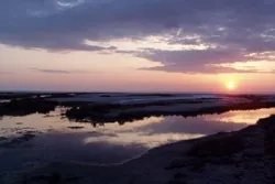 Санаторії та курорти для хворих на псоріаз (лікування Захворювання шкіри) Санаторії та курорти для хворих на псоріаз