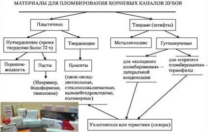 Силери (цементи для для пломбування кореневих каналів) класифікація та застосування