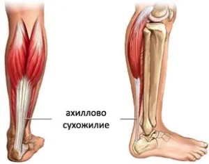 Симптоми розтягування ахіллового сухожилля (ахіллового сухожилля яке) Симптоми розтягування ахіллового сухожилля