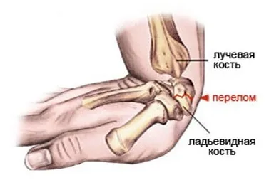 Сноуборд для початківців