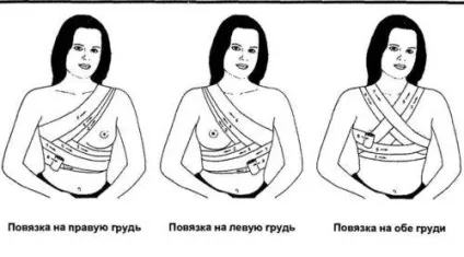 Сольові пов'язки при мастопатії компреси для лікування і протипоказання (лікування) Сольові пов'язки при мастопатії компреси для лікування і протипоказання