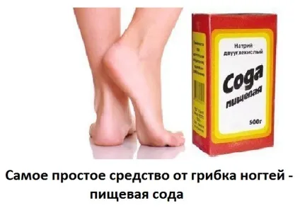 Сода від грибка нігтів на ногах, сайт про методи лікування докторів Неумивакіна, Болотова, огулова