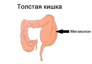 Спазмолітики механізм дії, показання, протипоказання (механізм) Спазмолітики механізм дії, показання, протипоказання