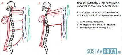 Спинальний інсульт причини, симптоми, лікування і прогноз інсульту