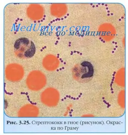 Стрептококи групи в
