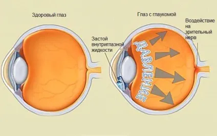 Таурин інструкція із застосування, очні краплі, для очей, користь (краплі) Таурин інструкція із застосування, очні краплі, для очей, користь