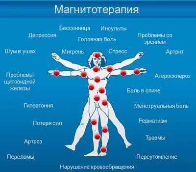 Магнітні браслети користь чи шкода (International People Group) Магнітні браслети користь чи шкода