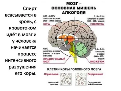 Тремор алкоголіка причини появи і лікування тремору рук (причини) Тремор алкоголіка причини появи і лікування тремору рук