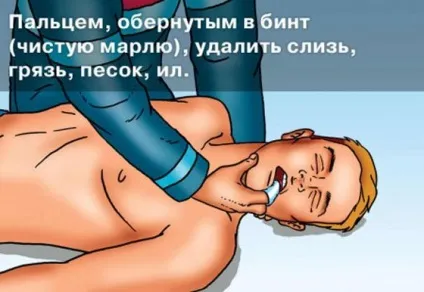 Утоплення, надання першої допомоги потопаючому (допомоги) Утоплення, надання першої допомоги потопаючому