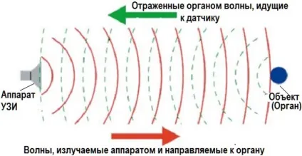 Узі підшлункової залози підготовка, таблиця з нормами, розшифровка результатів у жінок (нормами) Узі підшлункової залози підготовка, таблиця з нормами, розшифровка результатів у жінок