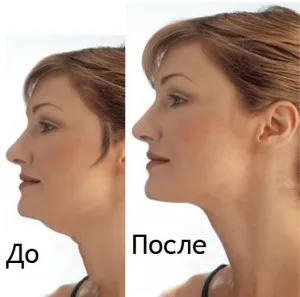 Друге підборіддя як прибрати в домашніх умовах, завжди у формі! (Домашніх) Друге підборіддя як прибрати в домашніх умовах, завжди у формі!
