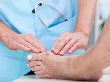 Халюс вальгус (hallux valgus) - операція або лікування народними засобами в домашніх умовах