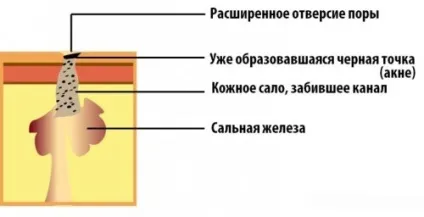 Забиті пори на обличчі як очистити в домашніх умовах (очистити) Забиті пори на обличчі як очистити в домашніх умовах