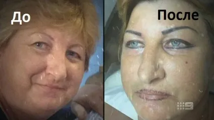 жертви косметологів